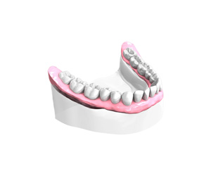 Remplacer toutes les dents absentes ou abîmées - Dentiste La Ciotat
